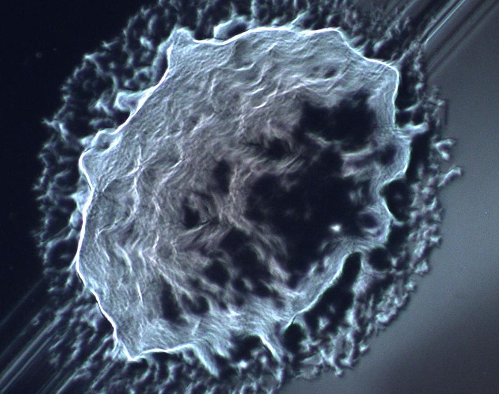 Pseudomonas aeruginosa Colony - Susanna Sherwin